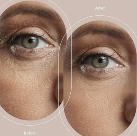 TROPHY SKIN Microderm MD Dermabrasion System. NEW & SEALED. - Picture 7 of 16